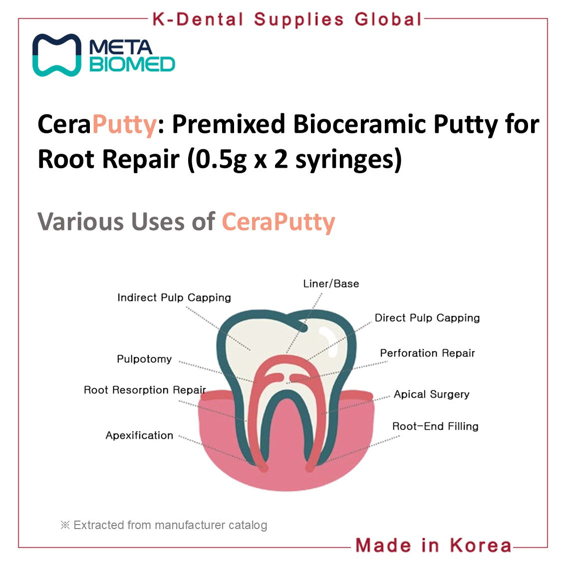 CeraPutty Premixed Bioceramic Putty (0.5g x 2 syringes)