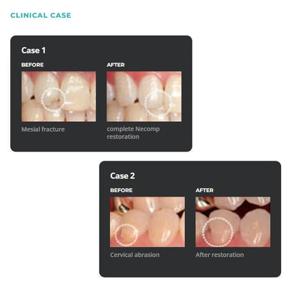 Nexcomp Nano Hybrid Dental Composite Resin 4g
