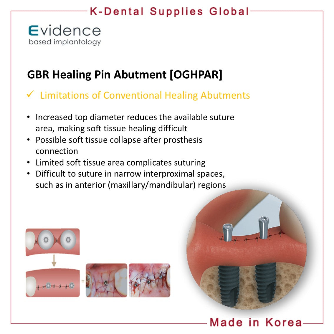 GBR Healing Pin Abutment