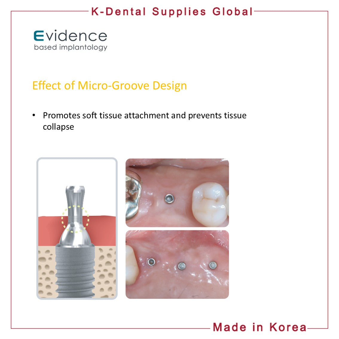 GBR Healing Pin Abutment