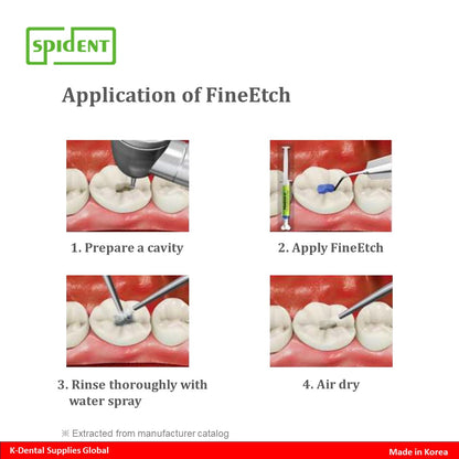 FineEtch(37% Etching Gel) 5ml x 3ea