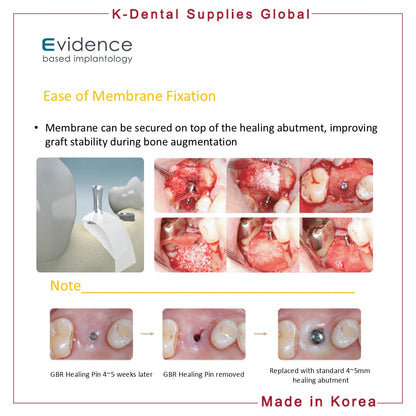 GBR Healing Pin Abutment